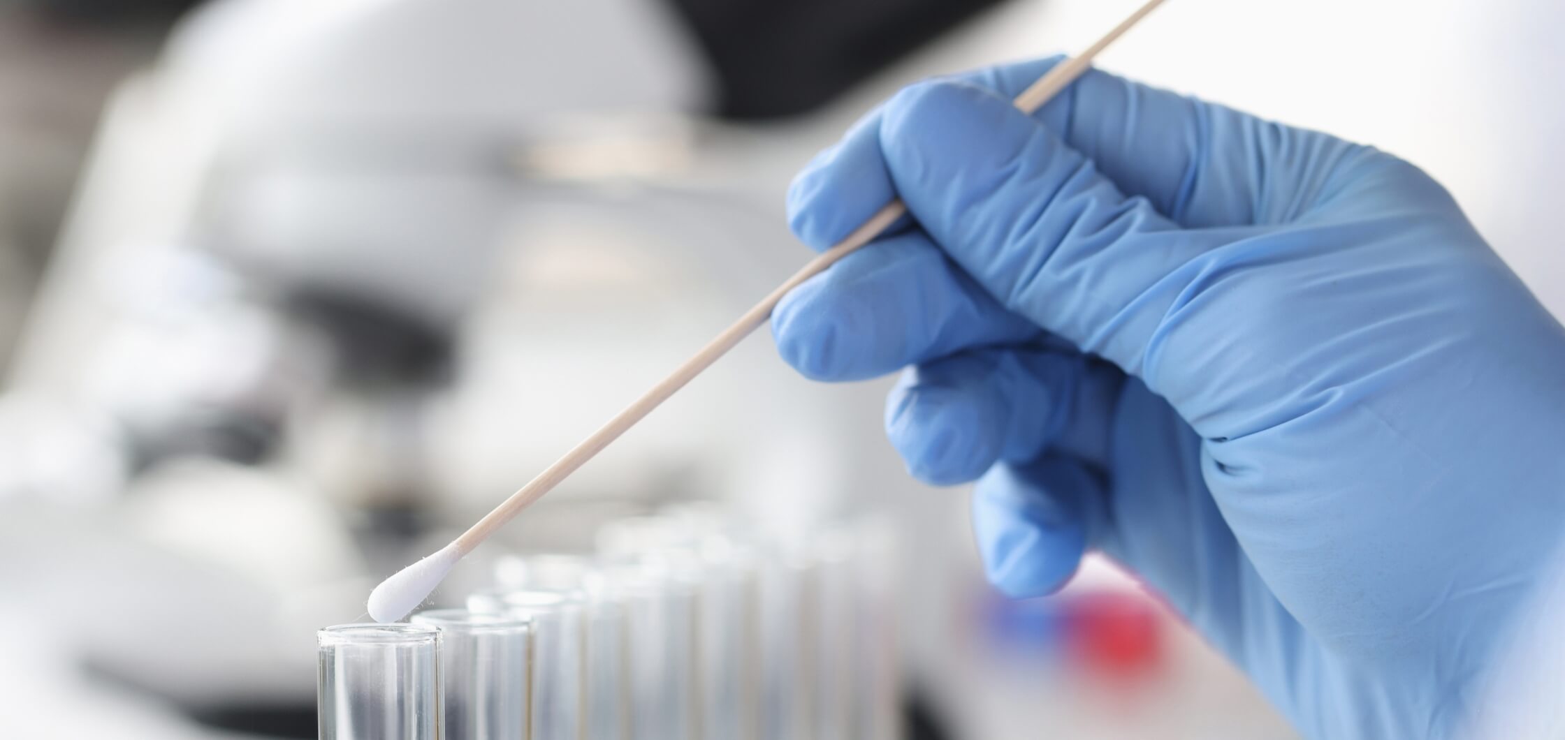 Why Mobile PCR Testing Matters for Wound Infections